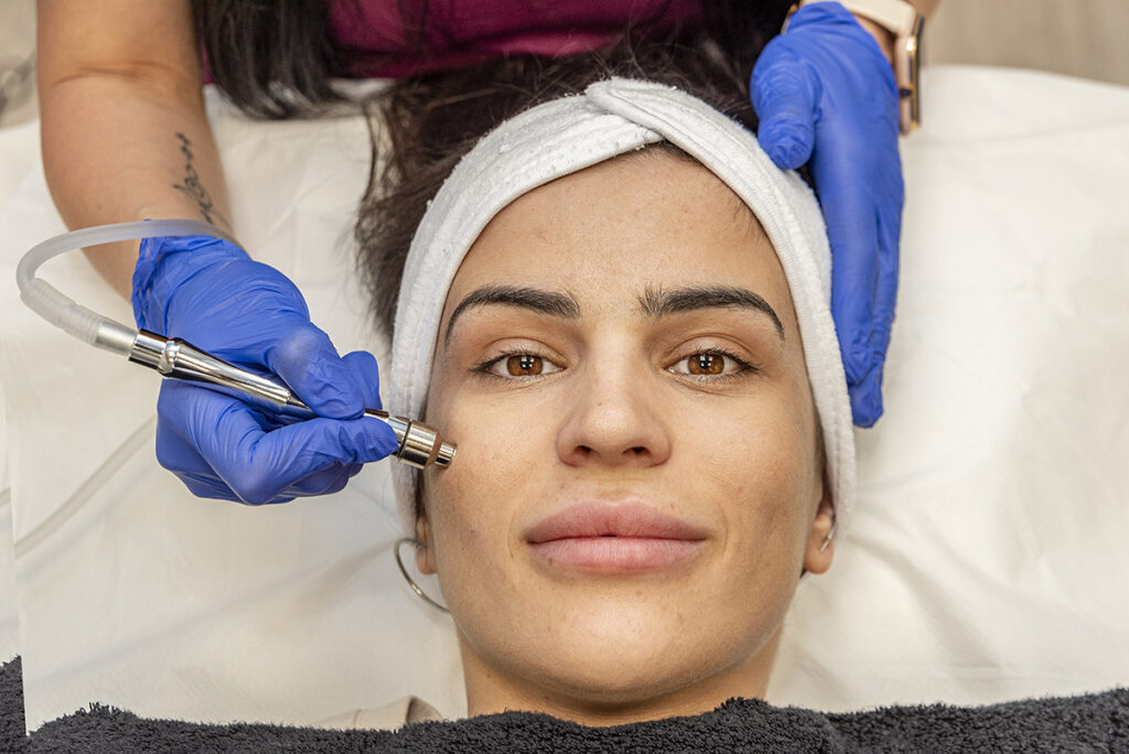 Los mejores tratamientos estéticos para eliminar arrugas